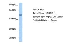 hnRNP H Rabbit anti-Human, Polyclonal, Novus Biologicals 0.1 mL | Buy Online | Novus Biologicals | Fisher Scientific
